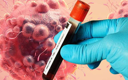 blood-test